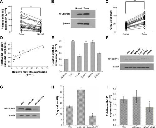 Figure 1 (A) Relative expression of miR-155 in 30 paired tumor and nontumor tissue samples of CRC measured by qRT-PCR (**P<0.01). (B) The expression of NF-κB (P65) protein in 30 paired tumor and nontumor tissue samples of CRC measured by Western blot. (C) Gray value of Western blot bands in (B) measured by ImageJ (**P<0.01) (D) Spearman’s correlation analysis was performed to assess the relationship between the expression levels of NF-κB (P65) and miR-155 (r=0.84194, P<0.01). (E) Relative expression of miR-155 in five human CRC cell lines (SW480, HT-29, SW620, Lovo, and Caco-2) compared to human normal colon epithelial cell line NCM460, measured by qRT-PCR (*P<0.05, **P<0.01) (F) Expression of NF-κB (P65) protein in five different CRC cell lines and human normal colon epithelial cell line NCM460 measured by Western blot. (G) Expression of NF-κB (P65) protein in SW480 cells after treatment with PBS, miR-155, and anti-miR-155, detected by Western blot. (H) Gray value of Western blot bands in (G) measured by ImageJ (*P<0.05). (I) Expression of miR-155 in SW480 cells after treatment with PBS, control siRNA (scramble), NF-κB siRNA, detected by qRT-PCR (*P<0.05).Abbreviations: NF-κB, nuclear factor kappa B; Scr, scramble; CRC, colorectal cancer; PBS, phosphate-buffered saline; miR-155, MicroRNA-155; siRNA, small interfering RNA.