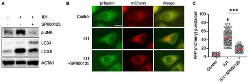 Figure 4. JNK inhibitor SP600125 blocks IU1-induced ER-phagy in HepG2 cells. (A–C) HepG2/mCherry-pHluorin-KDEL cells were treated with IU1 with and without SP600125 (10 µM) for 24 h. The cells harvested to analyze by Western blotting with indicated antibodies (A); the cells were fixed for imaging under a fluorescence microscope (B). Scale bar: 20 um; the number of puncta pHluorin(−) and mCherry(+) per cell was counted by assessing approximately 150 cells (C). The data are presented as the mean as the mean ± SD. **p < 0.01 and ***p < 0.001, by one-way ANOVA with the Bonferroni post hoc test.