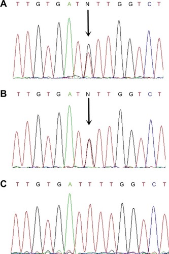 Figure 2 Mutation of the KIT gene.