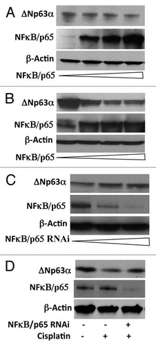Figure 2 NFκB/p65 mediates the reduction of ΔNp63α levels by cisplatin. (A and B) JHU-022 and p53/p63 deficient H1299 cells were transfected with increasing concentrations (0, 0.5, 1 and 1.5 µg) of NFκB/p65 expression plasmids as indicated; western blot was performed using the indicated antibodies. p53/p63 deficient H1299 cells were also transfected with 1 µg of ΔNp63α expression plasmid. (C) JHU-022 cells were transfected with increasing concentrations of either NFκB/p65 RNAi plasmid and subjected to western blot analysis using anti-p63 antibodies to assess the endogenous levels of p63. (D) JHU-022 cells were transfected with or without NFκB/p65 plasmid 24 h after transfection, the cells were treated with or without 75 µM cisplatin for 8 h, and cell lysates were subjected to western blot using anti-p63 antibodies.