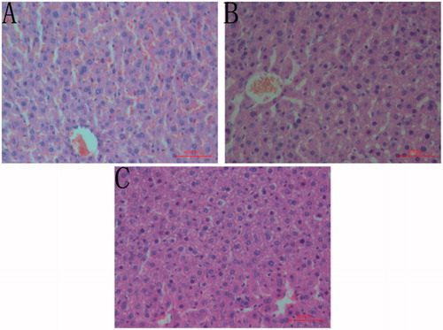 Figure 2. Liver sections of mice treated with PSS + castor oil (A), CFAE + castor oil (B) and PSS + PSS (C).