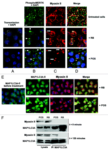 Figure 3. Analysis of changes in phospho-MERTK, MAP1LC3A-II and myosin II distribution in RB-or POS-exposed Sertoli cell cultures. Sertoli cell cultures either untreated or exposed to either POS or RB were stained for phospho-MERTK (green) (B) and myosin II (red) (C), in (D) merged images for phospho-MERTK and myosin II staining. DAPI stained nuclei are in blue. In the absence of POS and RB, phospho-MERTK distributes homogenously throughout Sertoli cell and myosin II distributed commonly in the cytoplasm and within cell boundaries. Within 2 h of Sertoli cell culture exposure to either RB or POS, phospho-MERTK redistributes forming clusters (B, arrowheads). While in RB-exposed Sertoli cells both peripheral myosin II and myosin II clumps are detected, in POS-exposed Sertoli cells only myosin II clumps but no peripheral myosin II were detected (C, arrows). (D) Shows phospho-MERTK clusters and myosin II clumps that colocalize on the site of Sertoli cell contact with either RB or POS. (E) Shows colocalization of MAP1LC3A-II with myosin II in POS-exposed but not RB-exposed Sertoli cell cultures. No clustering of MAP1LC3A-II was observed in control untreated Sertoli cells. Scale bar: 5 μm. (F) Depicts western blotting analysis of total cell lysates or MAP1LC3A-immunoprecipitated cell lysates showing that the co-immunoprecipitation of myosin II with MAP1LC3A occurs only in POS-exposed but not in RB-exposed Sertoli cell.