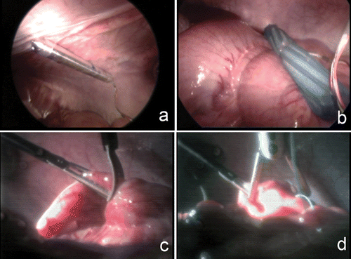 Figure 7. Imaging (a) and mobile camera (b) robots provide video feedback (c and d) during the cooperative laparoscopic procedure. [Color version available online.]