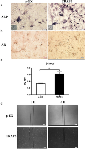 Figure 3. The effects of TRAF6 on proliferation, migration and osteogenesis of ADSCs. a: The osteogenesis detected by ALP. b: The osteogenesis detected by AR. c: The proliferation rate analysed by CCK-8 after transfection for 24 h. d: The migration rate analysed by wound healing. A t-test was used to compare p-ex and TRAF6. Data are expressed as mean ± SD referred to the control (*p<0.05); P-EX: blank vector; TRAF6: vector of overexpression of TRAF6, ALP: alkaline phosphatase, AR: alizarin red.