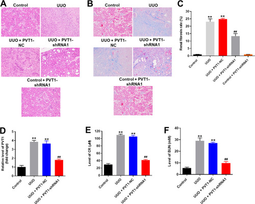 Figure 5 Silencing of PVT1 obviously attenuated the symptom of renal fibrosis in vivo. (A)H&E staining of mice kidney tissue in control, UUO, UUO+PVT1 NC, UUO+PVT1 shRNA1 or control+PVT1 shRNA1 group were detected. (B) Masson staining of mice kidney tissue in control, UUO, UUO+PVT1 NC, UUO+PVT1 shRNA1 or control+PVT1 shRNA1 group was detected. (C) The rate of fibrosis in mice was quantified. (D) The expression of PVT1 in kidney tissues of mice was detected by qRT-PCR. (E) The level of CR in serum of mice was measured by Creatinine Assay kit. (F) The level of BUN in serum of mice was measured by Urea Assay Kit. **P < 0.01 compared to control, ##P < 0.01 compared to UUO.