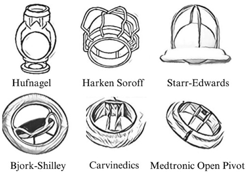 Figure 1. Valve designs over the ages.