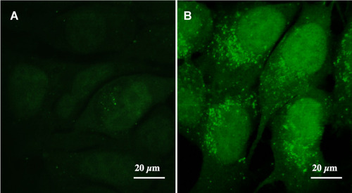 Figure 6 Uptake of curcumin (A) and curcumin loaded PLGA nanoparticles (B) by MCF-7 cells after 4 h of incubation as revealed by green fluorescence under the confocal microscope.
