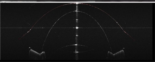 Figure 5 Detection of surface.