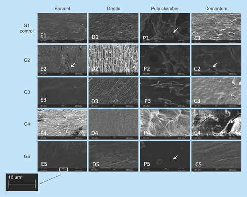 Figure 5.  SEM images of changes comparing structures as enamel, dentine, pulp chamber and cementum in groups (950×, 10 μm).Analysis on SEM images from different dental tissues, enamel, pulp, cementum and dentin. G1 (control group) and then other four experimental groups. The arrows identified on pictures E2 and C2 the presence of crackers; on the picture P1 the pulp presence can be identified and on the picture P5 the pulp absence can be observed. The image revealed the absence of biological residue on the group 5 probing hydrogen peroxide and enzymatic detergent the best solution for decellularization.