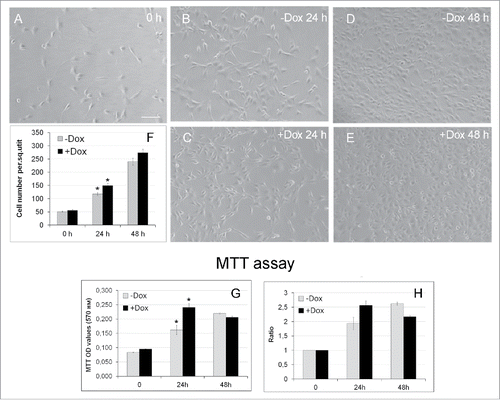 Figure 3. Effects of SURF6 overexpression on proliferation and viability of NIH/3T3-174 fibroblasts cultured without (-Dox) or with (+Dox) 100 ng/ml doxycycline up to 48 hours as analyzed with conventional phase contrast microscopy (A-F) and the MTT assay (G, H). (A-F) Cells were seeded in Petri dishes, cultured in complete growth medium for 3–4 hours to retrieve cell attachment to substrate. Twenty-five random fields of view were photographed shortly after doxycycline administration (“0” time-point, A) and 24 (B and C) and 48 (D and E) hours later, and representative images of the cells are shown in (A-E). Experiments were repeated five times, and in (F) bar graphs illustrating the mean cell number per field ± SEM are shown. The horizontal axis – time in hours, the vertical axis – the number of cells per square unit, small vertical bars – SEM. (G and H) Bar graphs illustrating MTT assay results. The horizontal axes – time in hours, the vertical axes in panel (G) – OD values at 570 nm, in panel (H) – the ODT /OD0 ratios equal to the OD values scored after 24 and 48 hours and normalized to the relative OD values at the “0” time-point. The data are presented as the mean ± SEM based on the results of three independent experiments.
