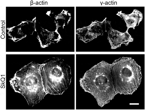 Figure 1. SkQ1 induced changes in cell morphology and actin organization in НТ1080. β-actin and γ-actin staining in the control and SkQ1-treated (40 nM,72 hours) HT1080 cells; immunofluorescence microscopy, scale bar 10 μm.