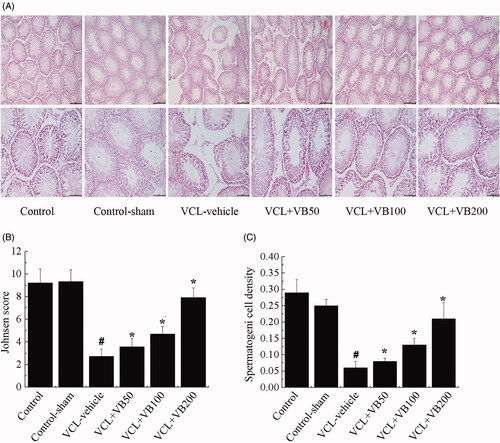 Figure 1. Histologic findings in testis. (A) Histological changes in the testis. Original magnifications 100×, 200×. (B) Spermatogenic cell density. (C) Johnsen’s score of the seminiferous tubules. *p < 0.05 vs. VCL-vehicle group, #p < 0.05 vs. Control group.