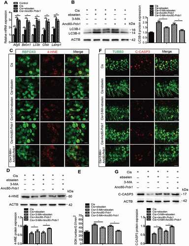 Figure 8. Ebselen and overexpression of PRDX1 protect against cisplatin-induced ROS accumulation and apoptosis and reduce SGN loss by activating autophagy in SGNs. The cultured cochleae from WT mice were treated with cisplatin (50 μM) alone, cotreated with ebselen (30 μM, pretreated for 1 h), cotreated with Anc80-Prdx1 (4 × 1010 GC/mL, preincubation for 24 h), or cotreated with 3-MA (5 mM, pretreated for 6 h) for 48 h. (A) RT-PCR results showed that the mRNA expression of genes associated with autophagic flux, including Atg5, Becn1, Lc3b, Ctsb, and Lamp1, was upregulated in SGNs induced by cisplatin, and the overexpression of PRDX1 by ebselen or Anc80-Prdx1 further enhanced the above gene transcriptions compared to the cisplatin-only group. (B) Ebselen and Anc80-Prdx1 both significantly increased the protein expression of LC3B-II compared to the cisplatin-only group, whereas the co-treatment with 3-MA effectively prevented the upregulation of LC3B-II expression induced by ebselen or Anc80-Prdx1. (C-G) The expressions of 4-HNE (C and D) and cleaved-CASP3 (F and G) were significantly decreased, and the number of surviving SGNs (E) was significantly increased in the Cis + ebselen group and in the Cis + Anc80- Prdx1 group compared to the cisplatin-only group, while co-treatment with 3-MA significantly reduced the effects of both ebselen and Anc80-Prdx1 on SGN ROS production, cell survival, and apoptosis. Scale bars: 12.5 μm in (C). Scale bars: 25 μm in (F). n = 6 for each subgroup. All data are presented as the mean ± SEM, * P < 0.05, ** P < 0.01