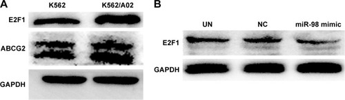 Figure 3 Expression level change of E2F1 protein after K562/A02 cells were transfected with miR-98 mimic.
