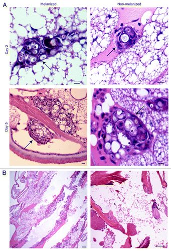 Figure 4. Histology of infected larvae. (A) Two or five days after infection with C. neoformans, larvae were sacrificed and fixed. Sections were stained with hematoxylin and eosin. C. neoformans cells were observed surrounded by hemocytes in inflammatory nodules. Arrows point to nodules Scale bar, 10 μm. (B) Left: five-day larvae with some tissue damage. Right: seven-day larvae with extensive tissue damage. Scale bars, 100 μm.