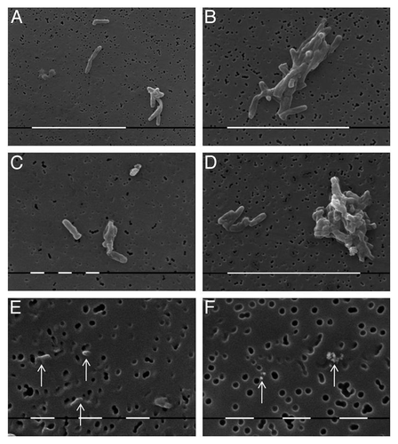 Figure 2. SEM of cells from culture of control strains: BCG-BG- (A), (B) and (E); and BCG-D- (C), (D) and (F). Typical single rod shaped bacilli (A) and (C), bacterial clusters (B) and (D), and filterable forms which size is similar or smaller than pore size of bacterial filter (E) and (F), arrows. Bar (white lines) = 10µm (A), (B) and (D); 1 µm (C), (E) and (F)