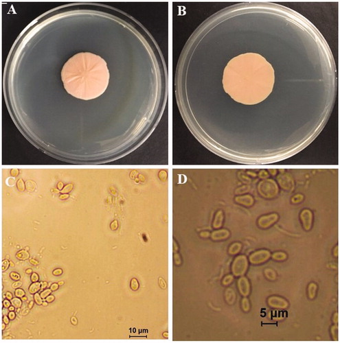 Figure 2. Yeast stage of Taphrina deformans on potato dextrose agar plates. (A) Obverse colony; (B) Reverse side of the colony; (C) Yeast cells; (D) Budding yeast cells and pseudo mycelium.