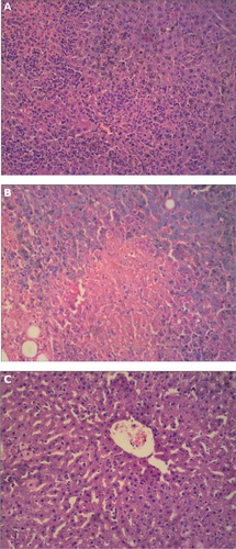 Figure 11 Pathological observation of acute hepatic damage caused by carbon tetrachloride in the rat. (A) Control group, (B) carbon tetrachloride group, and (C) and group treated with nanostructured lipid carriers loaded with both oleanolic acid and gentiopicrin.
