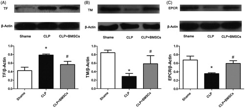 Figure 7. (A) TF, (B) TM, and (C) EPCR expression levels in lung tissues in the three groups were determined by western blot. β-Actin was used as a total protein loading control. Each blot was quantified by densitometry analysis. Data are expressed as mean ± SEM (n = 4 mice/group), and were compared by one-way ANOVA and SNK method; *p < 0.05 versus sham group; #p < 0.05 versus the CLP control group.