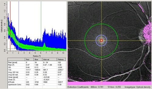 Figure 1 Macular pigment optical density map of one eye included in the study.