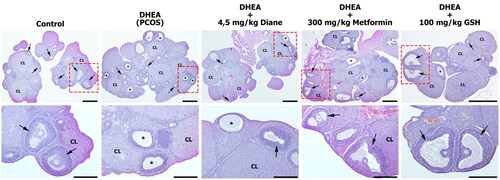 Figure 4. Photomicrographs of the representative ovary cross-sections in all experimental groups. Control group showed normal ovarian structures with several healthy follicles (arrow) at different developmental stages and corpus luteum (CL). DHEA (PCOS) group showed multiple cystic follicles (*) with a thin layer of flattened granulosa cells and a few healty follicles and CL. In the DHEA + 4,5 mg/kg Diane and DHEA + 300 mg/kg Metformin groups, number of cystsic follicles were decreased with the presence of growing healthy follicles. DHEA + 100 mg/kg GSH group showed a marked reduction in the of cystsic follicles with the presence of growing healthy follicles which were almost comparable with Control group. Healthy follicle (arrow), corpus luteum (CL), cystic follicle (*). Hematoxylin and eosin staining, Bar: 1000 µm in lower magnification and 500 µm in high magnification.
