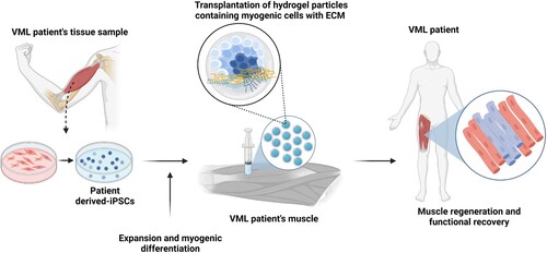 Figure 3. Schematic of iPSC-based cell therapy for VML patients. Similar to DMD patients, a tissue biopsy is used to generate iPSCs, which are then expanded in culture and induced to enter the myogenic pathway to produce muscle precursor cells. Alternatively, culture conditions may be modified to yield cultures containing multiple cells types found in skeletal muscle, such as motor neurons and immature myotubes. Due to the loss of the connective tissue scaffold in VML, a biomaterials-based matrix is transplanted with the iPSC-derived cells to support skeletal muscle regeneration. The transplanted cells utilize the artificial matrix enter myogenesis and effectively replace the loss muscle tissue.