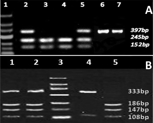 Figure 1. Agarose electrophoresis of restriction fragment length polymorphism (RFLP) products for (A). G22A polymorphism and (B) A4223C polymorphism analysis. (A) For G22A polymorphism lane 1 represents DNA ladder, GG genotype is represented in lanes 6 and 7 as a solo 397 bp fragment, lanes 3 and 4 indicate AA genotype with 245 and 152 bp fragments. In contrast, the GA genotype was identified by three 397, 245, and 152 bp fragments in lane 2 and 5. (B) For A4223C polymorphism lane 3 represents DNA ladder, lane 4 shows AA genotype with 108 and 333 bp fragments, lane 1 and 2 represent AC genotype with a set of four fragments (108, 147, 186, and 333 bp), and lane 5 shows CC genotype with three 108, 147, and 186 bp fragments.