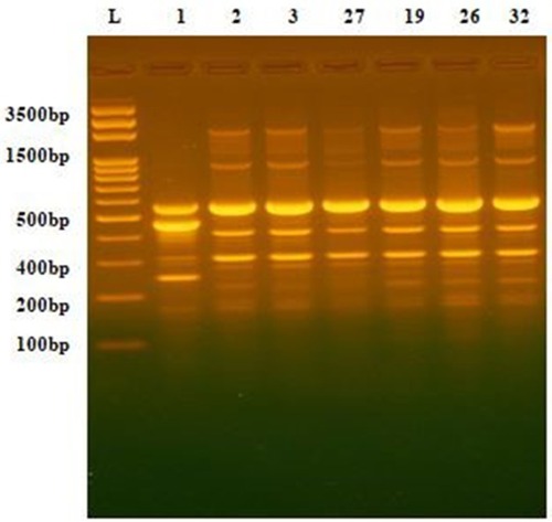 Figure 1 DNA fingerprint pattern generated by ERIC-PCR for Acinetobacter clinical isolates. L, 100bp DNA ladder; lanes 1, 2, 3, 27,19, 26 and 32 represent the code No. of the isolates.