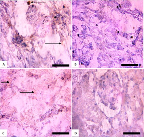 Figure 4. Immunohistochemistry of protein kinase B (PKB) in the kidneys of rats after withdrawal of sodium arsenite exposure for 4 weeks. (A) Control: shows positive and high expression of PKB; (B) 10 mg/kg NaAsO2 shows lower expression of PKB than control; (C) 20 mg/kg NaAsO2: shows no expression of PKB; (D) 40 mg/kg NaAsO2: shows no expression of PKB. The result shows that following withdrawal of NaAsO2, the expressions of the survival protein (Akt/PKB) are still lower than the control. Scale bar (for A, B, C, and D) = 5.04 × 3.87 mm. The slides were counterstained with high definition hematoxylin and viewed ×400 objectives.