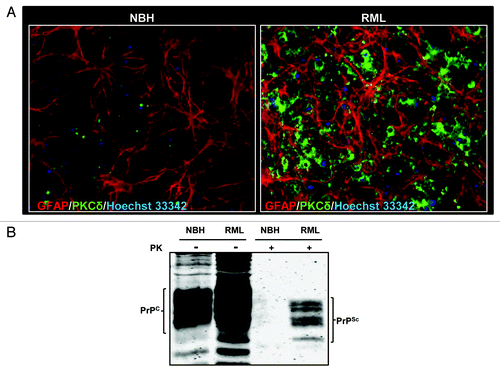 Figure 1. Prion replication and PKCδ upregulation in RML scrapie-infected organotypic cerebellar slice culture. (A) Immunohistochemical analysis of widespread astrogliosis and PKCδ upregulation in RML scrapie-infected cerebellar slice culture (right panel) as compared with control NBH-inoculated cerebellar slice culture (left panel). (B) Western blot analysis of the proteinase-K resistant PrPSc isoform after five weeks of RML infection in cerebellar slice cultures.