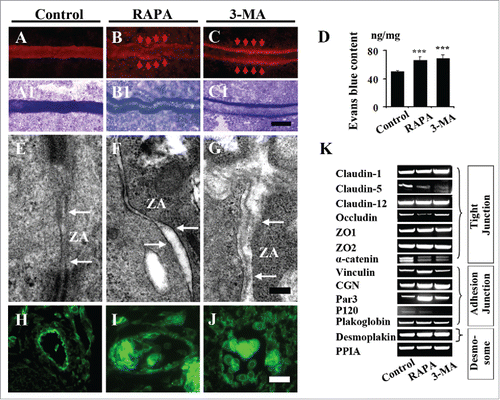 Figure 5. Both exposures of RAPA and 3-MA restrict the integrality of endothelium in YSM and CAM. (A-C) The representative fluorescent images of blood vessels in YSM of 3-day incubated embryos from control (A), RAPA-treated (B) and 3-MA-treated (C) groups. The photographs were taken after 2 h following the injection of Evans blue. (A1-C1) The bright field images of A-C respectively. (E-G) The transmission electronic microscope images from control and RAPA- or 3-MA-treated groups. (G) The bar chart showing the comparison of evans blue contents among control, RAPA-treated and 3-MA-treated groups. (H-J) The β-catenin immunofluorescent staining was performed on the transverse sections in the cranial regions of the 9d chick embryos control (H), RAPA-treated (I) and 3-MA-treated (J) groups respectively. (K) The RT-PCR data showing the expressions of Claudin-1, Claudin-5, Claudin-12, Occludin, ZO1, ZO2, α-catnin, Vinculin, CGN, Par3, CGN, P120, Plakoglobin, Desmoplakin and PPIA in control (0.1% DMSO), RAPA-treated and 3-MA-treated YSM tissues. Abbreviation: ZA, Zonula adherens. Scale bars = 300 µm A-C, A1-C1, 1 µm in E-G and 20 µm in E-G.