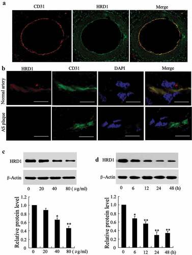 Figure 1. HRD1 expression is decreased in human atherosclerotic intima and ECs treated with ox-LDL. (a) Immunofluorescence staining for HRD1 (green) and CD31 (red) in normal arterial walls. Original magniﬁcation, ×100. (b) Immunostaining of HRD1 (red) and the endothelial marker CD31 (green) in normal arterial intima and atherosclerotic arterial intima. Bar = 20 μm. (c) Human umbilical vein endothelial cells (HUVECs) were treated with ox-LDL (0, 20, 40 and 80 μg/ml) for 24 h, followed by measurement of the protein levels of HRD1 and LOX-1. (d) HUVECs were treated with ox-LDL (80 μg/ml) for 0, 6, 12, 24 or 48 h, followed by measurements of the protein levels of HRD1 and LOX-1. Values are means ± SD and are representative of three individual experiments. *P < 0.05 and **P < 0.01, compared to 0 μg/ml or 0 h.