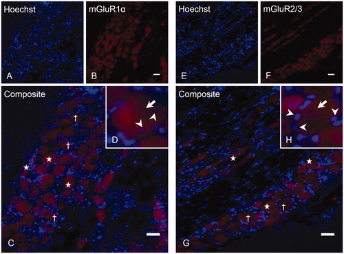 Figure 2. Expression of mGluR1α and mGluR2/3 in the TG. Labeling TG sections with rabbit anti-mGluR1α (B) and rabbit anti-mGluR2/3 (F), followed by counterstaining with Hoechst (A, E), revealed both positive (stars) and negative (cross) neurons (exemplified in 2C and G). Higher magnification of two positive neurons are shown for each mGluR staining (D, H, mGluR1α and mGluR2/3, respectively), where SGCs (arrowheads) were located inside the immunoreactive area (arrow) of the mGluR1α staining (D), indicating that trigeminal SGCs express mGluR1α. In contrast, SGCs (arrowheads) were located outside the immunoreactive area (arrow) of the mGluR2/3 staining (H), indicating that these SGCs do not express mGluR2/3. Magnification = 200× (A, B, C, E, F and G). Scale bars = 50 µm. mGluR, Metabotropic glutamate receptor; TG, trigeminal ganglion; SGCs, satellite glial cells.