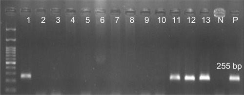 Figure 3 Detection of CP10 gene (255 bp) in Pseudomonas aeruginosa isolates.Note: Molecular pattern: 100 bp.Abbreviations: N, negative control; P, positive control.