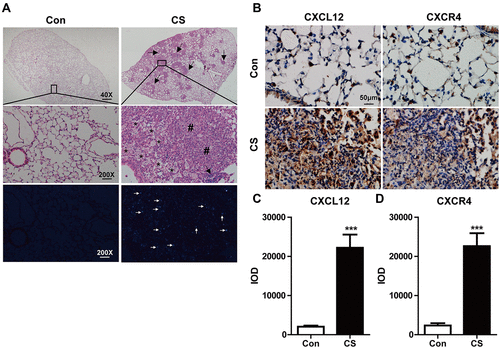 Figure 1 Silica particles induced pathological changes and increased CXCL12/CXCR4 expression in the mouse lung. (A) Represent histological sections of mouse lung on day 28 in CS-exposed group versa control one. Mice were administrated intranasally with 12 mg CS in 60 µL PBS and 60 µL PBS as the vehicle control. The low magnification (40×) of CS-exposed lung showed extensive silica nodule formation compared with the control in upper images. The large magnification (200×) showed lung architecture is normal in the control group (N=6), and the CS group (N=6) showed obvious trachea and alveolar wall thickening, inflammatory cells infiltration, and the formation of silicotic nodules in the middle images. Arrows indicate lymphoid clusters. Asterisk indicates reactive inflammatory cells. Pound signs indicate silicotic nodules. The bottom images showed crystalline silica under a polarizing light microscope. White arrows indicate CS. (B) The expressions of CXCL12/CXCR4 in the lung were assessed after CS exposure by immunohistochemistry staining. The quantitative analyses of CXCL12 (C) and CXCR4 (D) expression in the lung were shown. IOD: integrated optical density. Scale bar: 50 µm. ***P < 0.001 vs the control group.