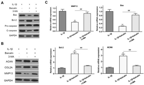 Figure 4 Baicalin protects human OA chondrocytes against IL-1β-induced apoptosis and ECM degradation depending on autophagy activity. (A) The effects of baicalin and IL-1β on the expression of apoptosis-related proteins with or without autophagy inhibitor 3-methyladenine (3-MA) were examined by Western blot. (B) The effects of baicalin and IL-1β on the expression of ECM components with or without autophagy inhibitor 3-methyladenine (3-MA) were examined by Western blot. (C) The effects of baicalin and IL-1β on the expression of apoptosis-related proteins and ECM components and metalloproteinase with or without autophagy inhibitor 3-methyladenine (3-MA) were also assessed by qRT-PCR. **p < 0.01 compared with IL-1β alone treated group, ##P<0.01 compared with IL-1β+baicalin group.