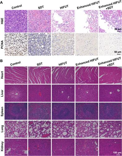 Figure 9 (A) H&E and PCNA staining of tumor tissues after various treatments. (B) H&E staining of major organs of mice after various treatments.