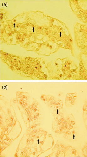 Figure 3. Cuticular epithelium of the pleopod infected with WSSV. (a) and (b): Paraffin sections from L. aztecus, × 400. Arrows indicate heavily infected cuticular epithelial cells showing large basophilic inclusions characteristic of WSSV infection. Figura 3. Epitelio cuticular obtenido de tejido de pleopodos infectados con WSSV. (a) and (b): Secciones de parafina obtenidas de muestras de P. aztecus. × 400. Las flechas indican células de epitelio cuticular mostrando las grandes inclusiones basófilas características de la infección por WSSV.
