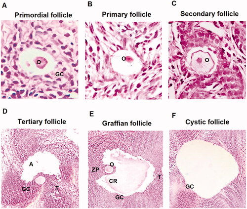 Figure 1. Histological analysis of various ovarian follicles in PCOS induced and control rats. (A) Primordial follicle showing flat layer of granulosa cells (GC) along with oocytes (O) at ×40. (B) Primary follicles with well-defined oocyte ×40. (C) Secondary follicle having fluid and defined oocyte ×40. (D) Tertiary follicle having theca (T), granulosa cells (GC) and antrum (A) ×40. (E) Graffian follicle having a huge antrum, oocyte, corona radiate (CR) and zona pellucida (ZP) ×40. (F) Cystic follicle showing a huge antrum devoid of oocyte. All images were captured at ×40.