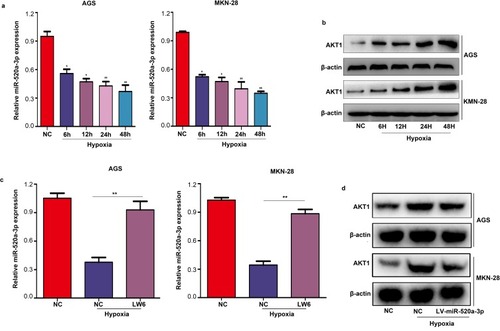 Figure 7 MiR-520a-3p/AKT1 was regulated by HIF1α under hypoxia. (A) qRT-PCR was used to detect the expression of miR-520-3p in AGS and MKN-28 cells under hypoxia. (B) Western blotting was used to detect the expression of AKT1 under hypoxia. (C) qRT-PCR were used to detect the expression of miR-520-3p in AGS and MKN-28 cells after treatment with LW6 (an inhibitor of HIF1α) under hypoxia. (D) Western blotting was used to detect the expression of AKT1 in the miR-520a-3p-overexpressing group under hypoxia. *P<0.05; **P<0.01.Abbreviations: AKT1, AKT serine/threonine kinase 1; HIF1α, hypoxia inducible factor 1 subunit alpha; qRT-PCR, Quantitative real-time fluorescence PCR.
