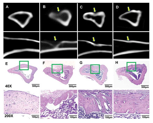 Figure 5. Cross (top) and longitudinal (bottom) views of CT scanning for the (a) control group (normal rat tibia with no defect), (b) tibia wound group (no dressing covering), (c) DAM group, and (d) DAM-POC group after 8-week repairing; Masson’s trichrome staining of the (e) control group, (F) tibia wound group, (g) DAM group, and (h) DAM-POC group after 8-week repairing. Bone defects were indicated with arrows in B–D. Lower magnification (top) and higher magnification (bottom) of area in green rectangle were indicated in E–H