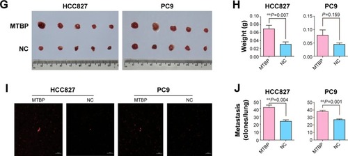 Figure 3 Overexpression of MTBP promotes lung adenocarcinoma cells invasion and migration both in vitro and in vivo.