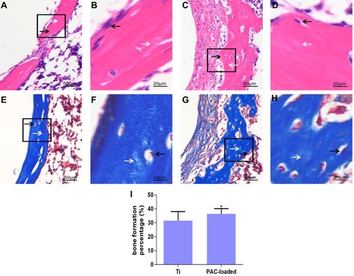 Figure 10 Histological analysis of the decalcification samples around Ti (A, B, E, F) and PAC-loaded (C, D, G, H) implants.Notes: (A-D) H&E staining; (E-H) Masson staining; (I) BF %. B, D, F and H depict zoomed areas of black box in A, C, E and G, respectively. Bars indicate 50 µm (A, C, E, G) and 20 µm (B, D, F, H). The black arrow denotes new bone formation; white arrow denotes osteoblast cell. Histological morphology analyses based on H&E staining after 2 weeks implantation was expressed as was BF % and shown in (I). Data are expressed as mean ± SD (n=3), *A statistical significance compared to the Ti group (P<0.05).Abbreviations: PAC, proanthocyanidins; Ti, titanium; BF%, bone formation percent.