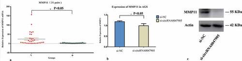 Figure 4. Relative expression of MMP11 in human GC cell lines transfected with specific siRNA targeted circRNA0047905.