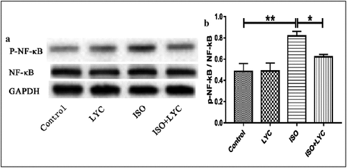 Figure 4. Treatment Of LYC Suppressed Cardiac Inflammation Partially By Inhibiting Activation Of The NF-Κb Signaling Pathway. (a,b) The Protein Level Of Activated NF-Κb Was Measured By Western Blotting. *P < 0.05 And **P < 0.01 Mean Statistic Significance
