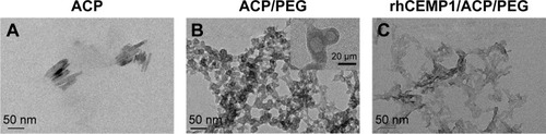 Figure 1 Transmission electron micrographs of ACPs prepared with or without PEG and rhCEMP1.Notes: (A) ACP nanoparticles obtained without the presence of PEG had a needlelike shape. (B) The addition of PEG in ACP resulted in a core-shell structure. (C) After the incorporation of rhCEMP1 into the ACP nanoparticles, irregular morphology was observed.Abbreviations: ACP, amorphous calcium phosphate; PEG, poly(ethylene glycol); rhCEMP1, recombinant human cementum protein 1.