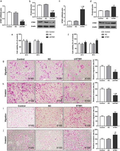 Figure 4. STIM1 silencing attenuated the abilities of proliferation, migration and invasion in ox-LDL induced MOVAS cells. MOVAS cells were subjected to ox-LDL, and then transfected with unspecific scrambled siRNA, STIM1 siRNA, pcDNA3.1(+) and pcDNA3.1(+)-STIM1 plasmids. (a-d) The levels of STIM1 were detected by RT-qPCR (a, c) and Western blot (b, d). (e, f) Cell viability was tested by CCK-8. (g-j) Cell migration (g, i) and invasion (h, j) were evaluated using transwell assay. *P< 0.05, **P< 0.01, versus control. #P< 0.05, ##P< 0.01, versus NC.