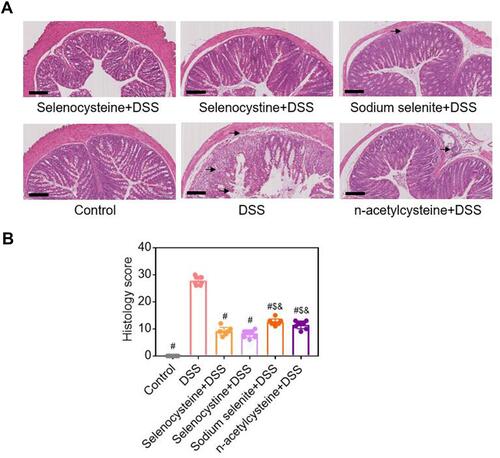 Figure 3 Histological examinations of effects of selenium-containing amino acids on DSS-induced IBD in mice. (A) Representative H&E-stained colon sections of each group (scale bar, 200 μm); (B) Histological scoring of mice treated with selenium-containing amino acids in DSS-induced IBD. Eight mice per group; #P < 0.05, compared with DSS group. $P < 0.05, compared with selenocysteine group. &P < 0.05, compared with selenocystine group. Data are expressed as mean ± SEM.