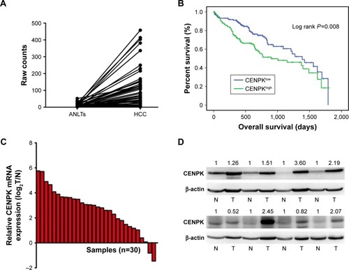 Figure 1 CENPK is upregulated in HCC tissues.Notes: (A) Expression of CENPK in TCGA database (n=50). (B) Overall survival of HCC patients with high/low CENPK expression in TCGA database (P=0.008). (C) mRNA levels of CENPK in HCC tissues and ANLTs were detected by qRT-PCR (n=30). (D) Protein levels of CENPK in HCC tissues and ANLTs were detected by Western blotting (n=8). N represents ANLTs; T represents HCC tissues.Abbreviations: HCC, hepatocellular carcinoma; ANLTs, adjacent non-tumor tissues; qRT-PCR, quantitative real-time PCR; TCGA, the Cancer Genome Atlas.