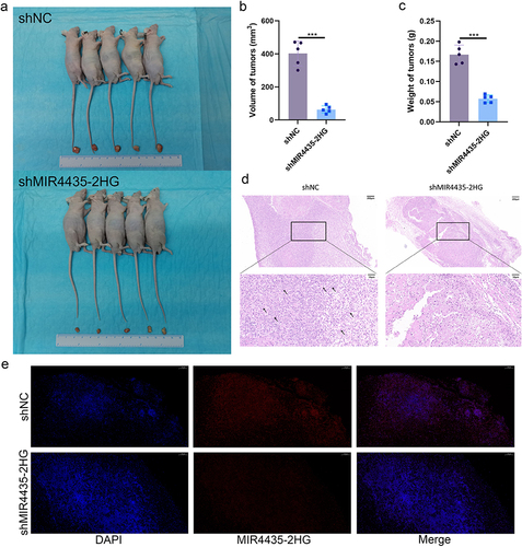 Figure 4 MIR4435-2HG downregulation inhibits the growth of HemECs in vivo. (a). Tumors of nude mice were dissected 2 weeks after subcutaneous injection in shNC and shMIR4435-2HG groups (5 mice in each group). (b). Tumor volume was significantly reduced in the shMIR4435-2HG group compared with that in the shNC group. (c). Tumor weight was significantly reduced in the shNC group compared with the shMIR4435-2HG group. (d). Typical H&E staining of tumors with abundant microvessels visible in the shNC group. The arrows indicate the microvessels. (e). Expression and localization of MIR4435-2HG in tumor tissues of shNC and shMIR4435-2HG groups were detected using FISH. Scale bar, 100 μm.(Student’s t-test, ***P < 0.001).